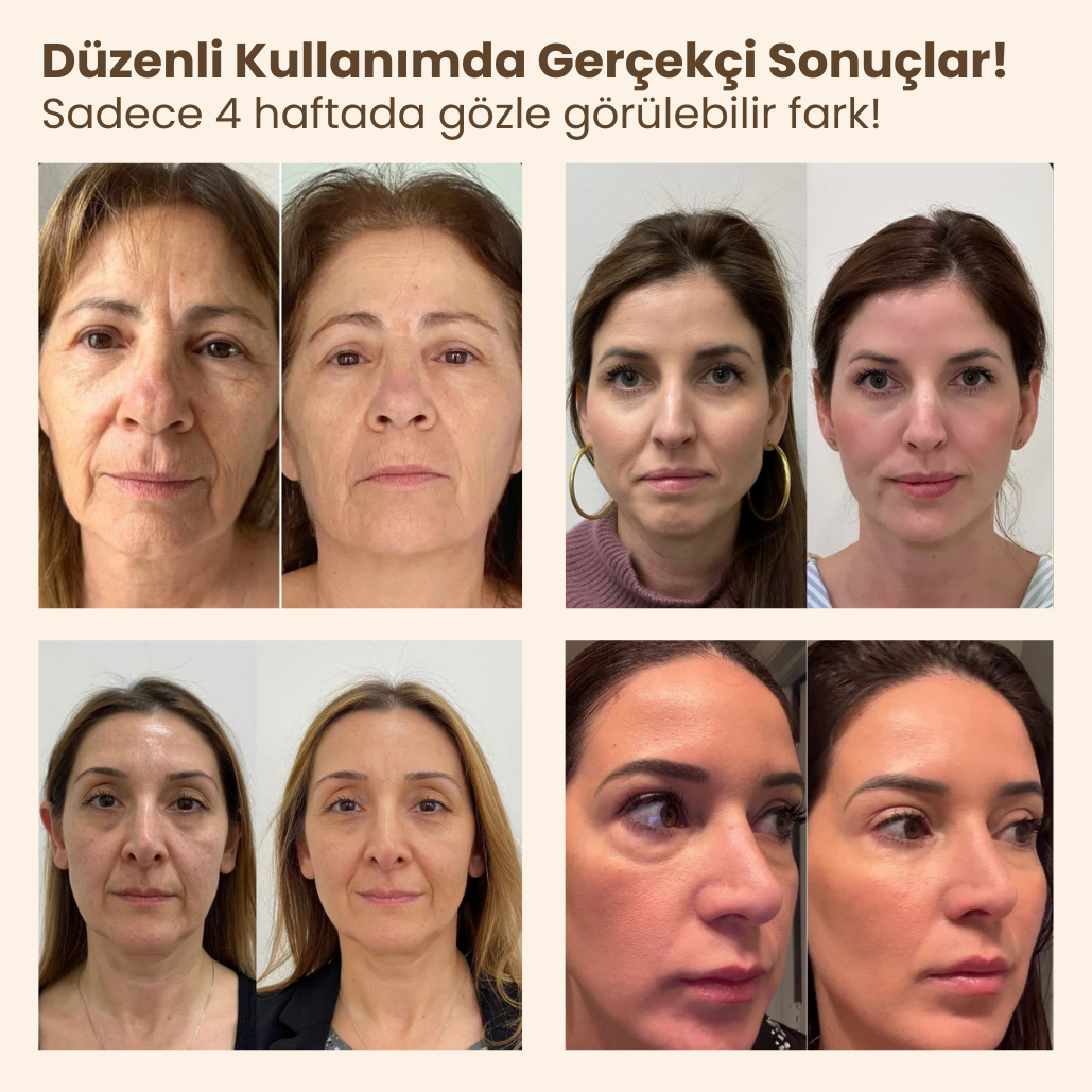 DermaLenf Drenaj Masaj Fırçası